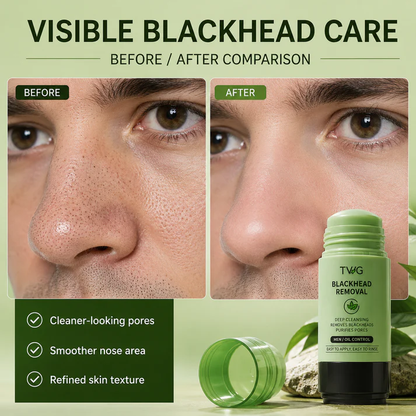 Green Tea Clay Mask Stick – Daily Skin Reset Ritual 💚